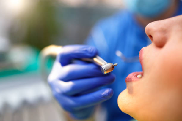 Oral Cancer Screening in Long Beach, CA